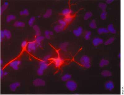 Anti-GFAP-labeled astrocytes in mixed-rate neural progenitor cultures.