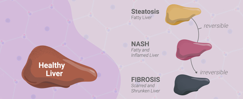 liverinfographic2