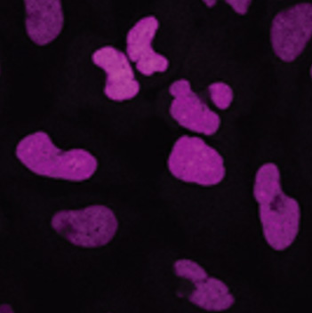 Cell image of parental U2OS cells and U2OS cells stably expressing HaloTag® protein fused to three copies of a nuclear localization sequence (labeled with Janelia Fluor® 635 HaloTag® Ligand).