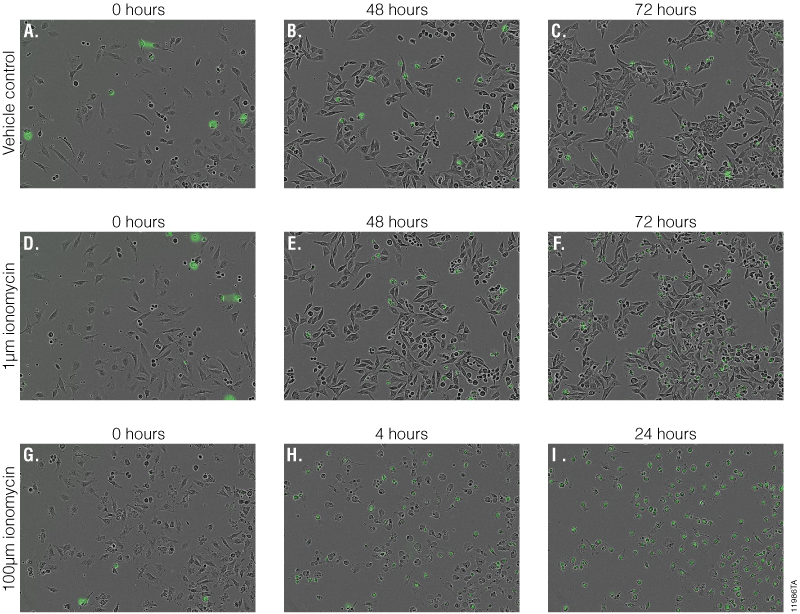 Representative images taken from the same assay well of HeLa cells treated with DMSO vehicle (Panels A–C), 1µM ionomycin (Panels D–F), or 100µM ionomycin (Panels G–I).